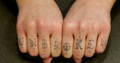 A Pure Non-Invasive Methodology to Take away Undesirable Tattoos