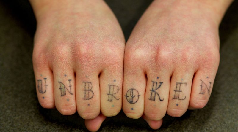 A Pure Non-Invasive Methodology to Take away Undesirable Tattoos
